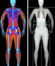 Book an Appointment with The Ability Clinic for DEXA Body Composition