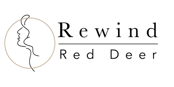 Rewind Red Deer